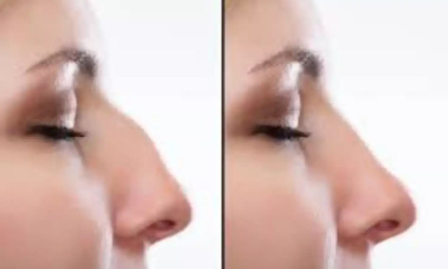 मेडिकल ने साल भर में 119 चेहरों को बना दिया खूबसूरत