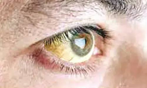 सप्ताहभर में पीलिया ने ली तीन की जानें!, स्वास्थ्य विभाग को कानो कान खबर नहीं सप्ताहभर में पीलिया ने ली तीन की जानें!, स्वास्थ्य विभाग को कानो कान खबर नहीं