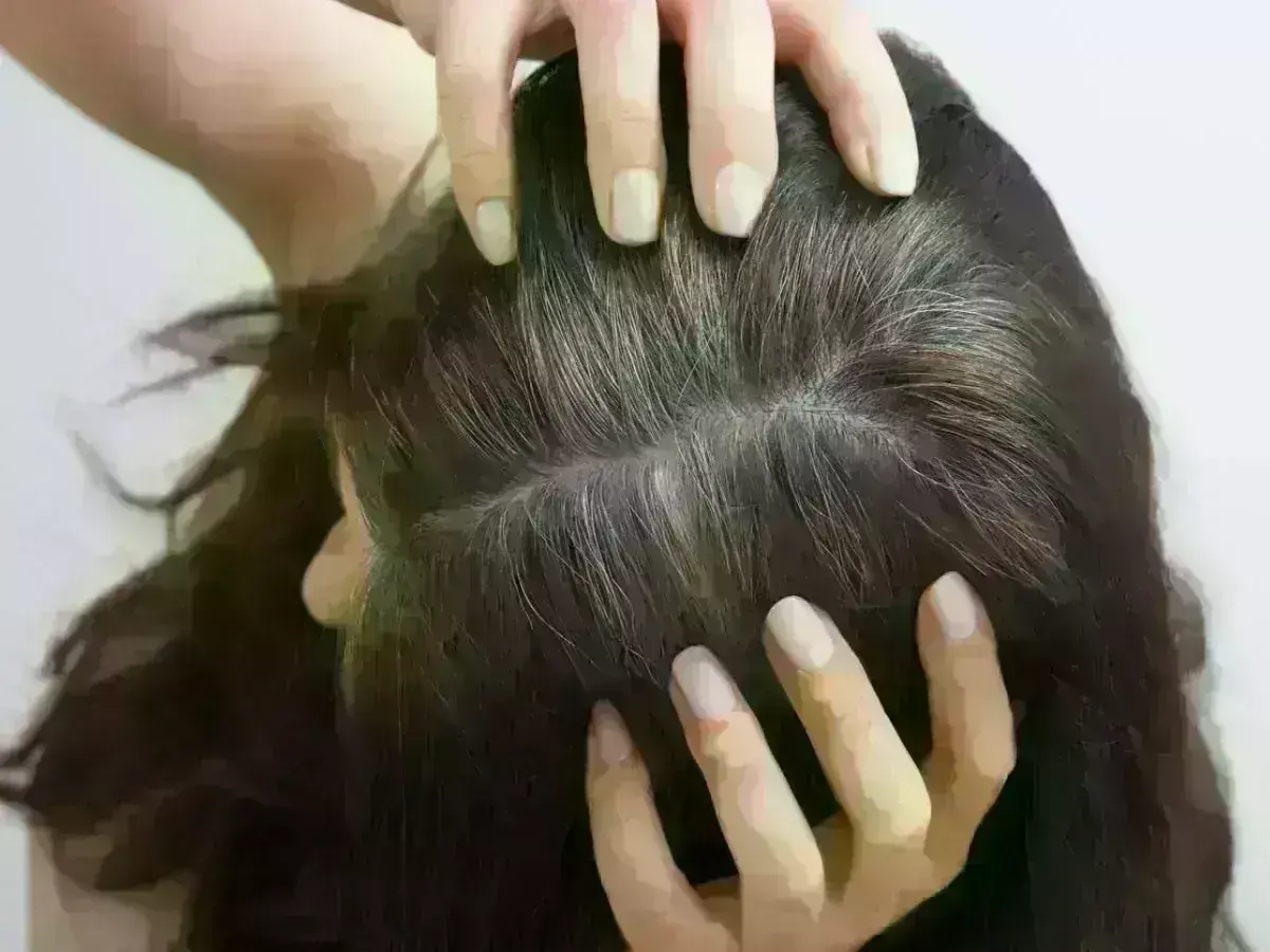 सफेद बालों को करना है नैचुरली काला तो, आंवले का इस तरह से करें इस्तेमाल