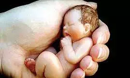 बीमारी ने रोकी किलकारी, पेल्विक टीबी से पीड़ित महिलाओं में बांझपन का खतरा बीमारी ने रोकी किलकारी, पेल्विक टीबी से पीड़ित महिलाओं में बांझपन का खतरा