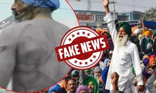कुरुक्षेत्र में पुलिस की पिटाई में किसानों को आई गंभीर चोट, जानें इन वायरल तस्वीरों की सच्चाई