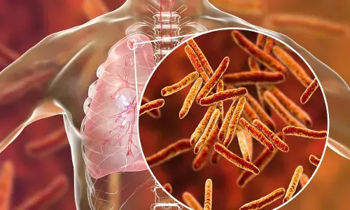 दवा प्रतिरोधी टीबी के इलाज में नई उपचार प्रणाली करें लागू, इलाज से थक चुके मरीजों ने दायर की ऑनलाइन पिटीशन