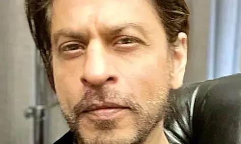 अमेरिका में शूटिंग के दौरान घायल हुए शाहरुख खान, करानी पड़ी सर्जरी अमेरिका में शूटिंग के दौरान घायल हुए शाहरुख खान, करानी पड़ी सर्जरी