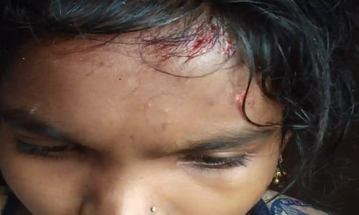 मूसलाधार बारिश से बचने पेड़ के नीचे खड़े बच्चाें पर गिरी बिजली