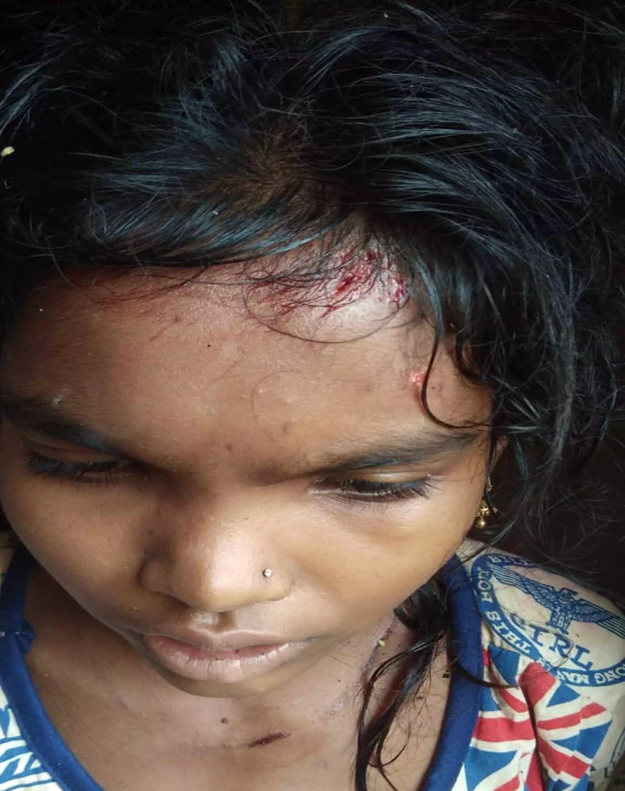 मूसलाधार बारिश से बचने पेड़ के नीचे खड़े बच्चाें पर गिरी बिजली मूसलाधार बारिश से बचने पेड़ के नीचे खड़े बच्चाें पर गिरी बिजली