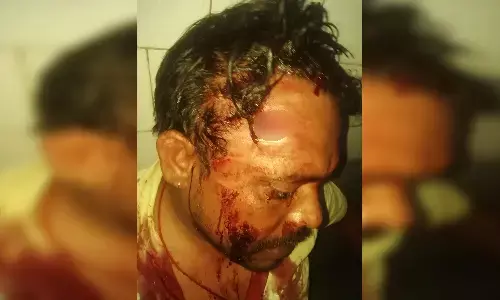 पचास हजार के लोन की वसूली पर पहुंचे आरएम अधिकारी पर प्राणघातक हमला पचास हजार के लोन की वसूली पर पहुंचे आरएम अधिकारी पर प्राणघातक हमला