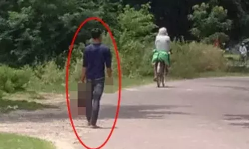 यूपी में बहन का कटा सिर लेकर घूमता रहा शख्स, गिरफ्तार यूपी में बहन का कटा सिर लेकर घूमता रहा शख्स, गिरफ्तार