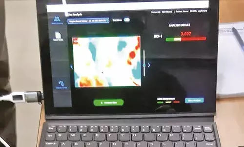 5 से 10 मिनट में ओरल व स्तन कैंसर का पता 5 से 10 मिनट में ओरल व स्तन कैंसर का पता