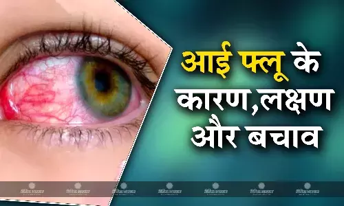 बारिश के मौसम में बढ़ रहा है आई फ्लू का खतरा, जानिए क्या हैं इसके कारण, लक्षण और बचाव