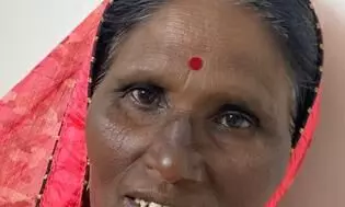 अंतिम संस्कार में घुस आए बौराए श्वान ने चार को काटा अंतिम संस्कार में घुस आए बौराए श्वान ने चार को काटा