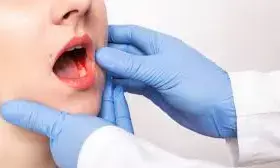 मुंह के कैंसर से बचाव को टाटा अस्पताल ने तैयार किए मौखिक कैंसर वॉरियर्स