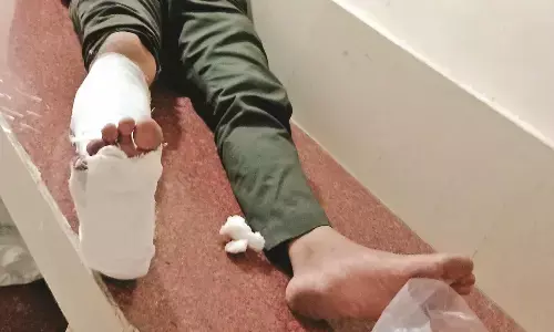 तस्वीरें निकालीं, तो गोवंश तस्करों ने युवक के पैर पर चढ़ा दी कार तस्वीरें निकालीं, तो गोवंश तस्करों ने युवक के पैर पर चढ़ा दी कार