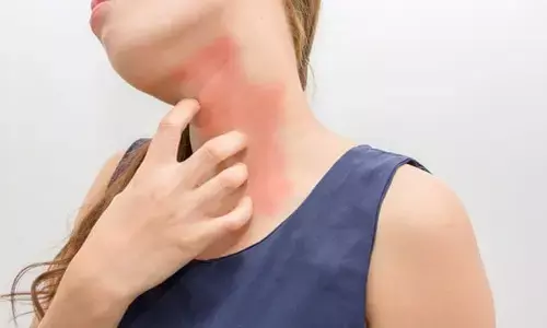 एलर्जी क्या हैं, एलर्जी के कारण, लक्षण और बचाव - जाने डॉ भावना राय पटेल से एलर्जी क्या हैं, एलर्जी के कारण, लक्षण और बचाव - जाने डॉ भावना राय पटेल से