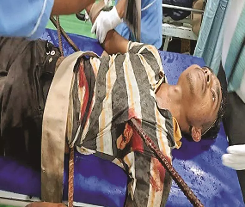 जख्मी युवक के सीने और पेट में घुसीं लोहे की छड़ें, सेवन स्टार के डॉक्टरों ने दिया जीवन जख्मी युवक के सीने और पेट में घुसीं लोहे की छड़ें, सेवन स्टार के डॉक्टरों ने दिया जीवन