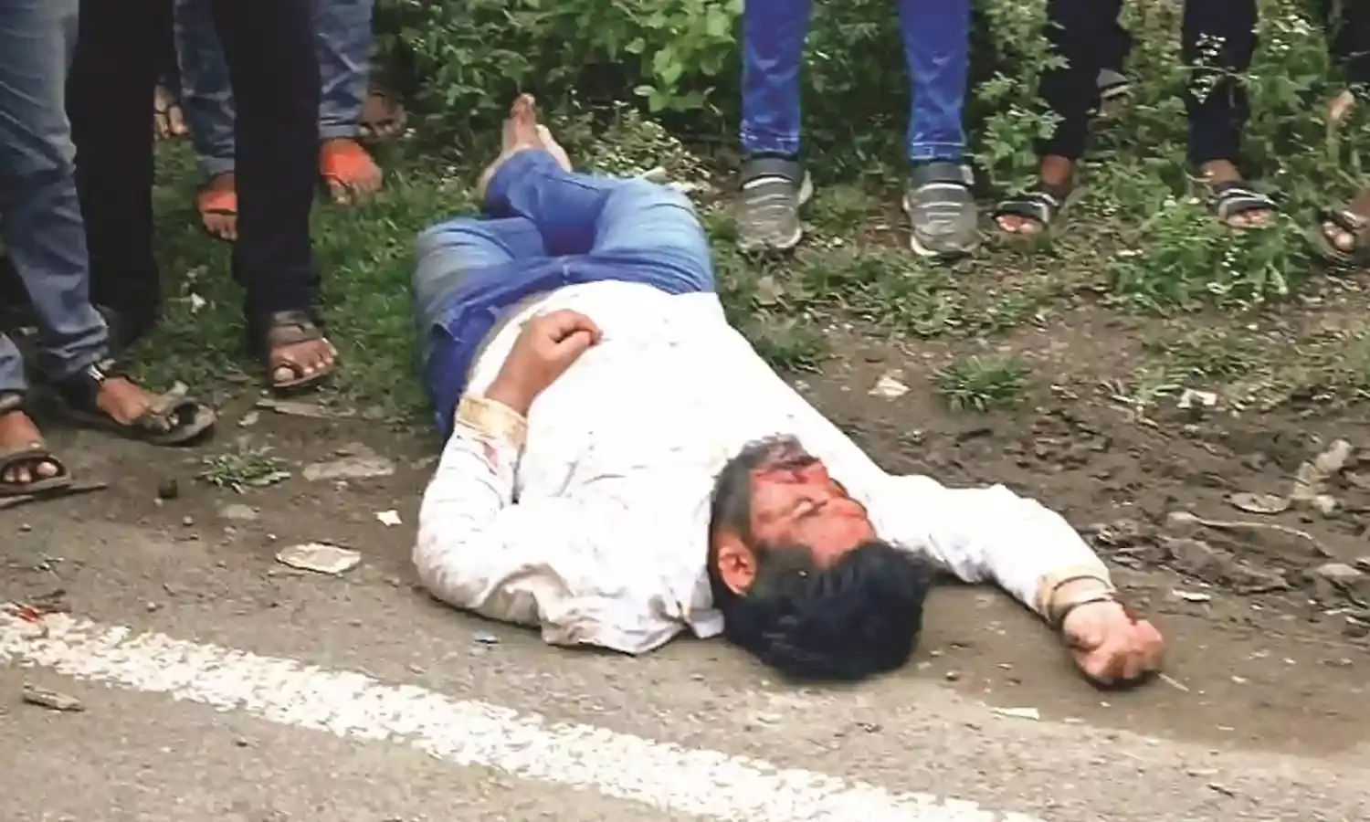 हादसे में 3 गंभीर रुप से घायल, वन पर्यटन केंद्र के समक्ष हादसों का सिलसिला जारी