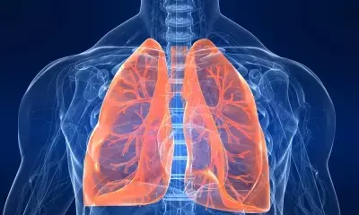 हल्के कोविड संक्रमण वाले 25 प्रतिशत मरीज एक साल बाद भी फेफड़ों की बीमारी से पीड़ित