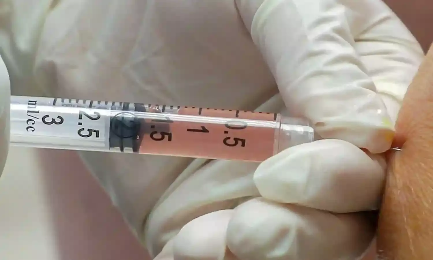 कोविड-19 से होने वाली मौतों के जोखिम को 60 प्रतिशत तक कम कर सकती है सेल थेरेपी