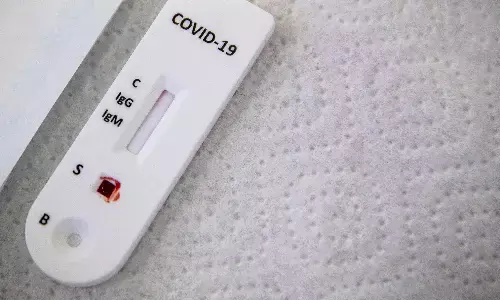 अमेरिकी सरकार ने की कोविड जांच किट के निर्माण में 600 मिलियन डॉलर निवेश की घोषणा अमेरिकी सरकार ने की कोविड जांच किट के निर्माण में 600 मिलियन डॉलर निवेश की घोषणा