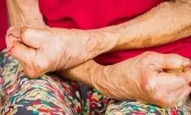 वर्ष 2025 तक खत्म होगा कुष्ठ रोग वर्ष 2025 तक खत्म होगा कुष्ठ रोग