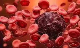 समुपदेशन से 70% मरीज कैंसर से लड़ने हो रहे तैयार समुपदेशन से 70% मरीज कैंसर से लड़ने हो रहे तैयार