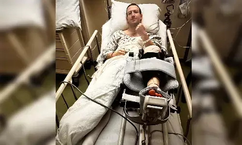 घुटने में लगी चोट के बाद मार्क जुकरबर्ग ने कराई सर्जरी घुटने में लगी चोट के बाद मार्क जुकरबर्ग ने कराई सर्जरी