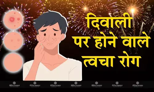 दिवाली पर होने वाले त्वचा रोग उनकें, कारण, लक्षण एवं बचाव, जानें एक्सपर्ट से