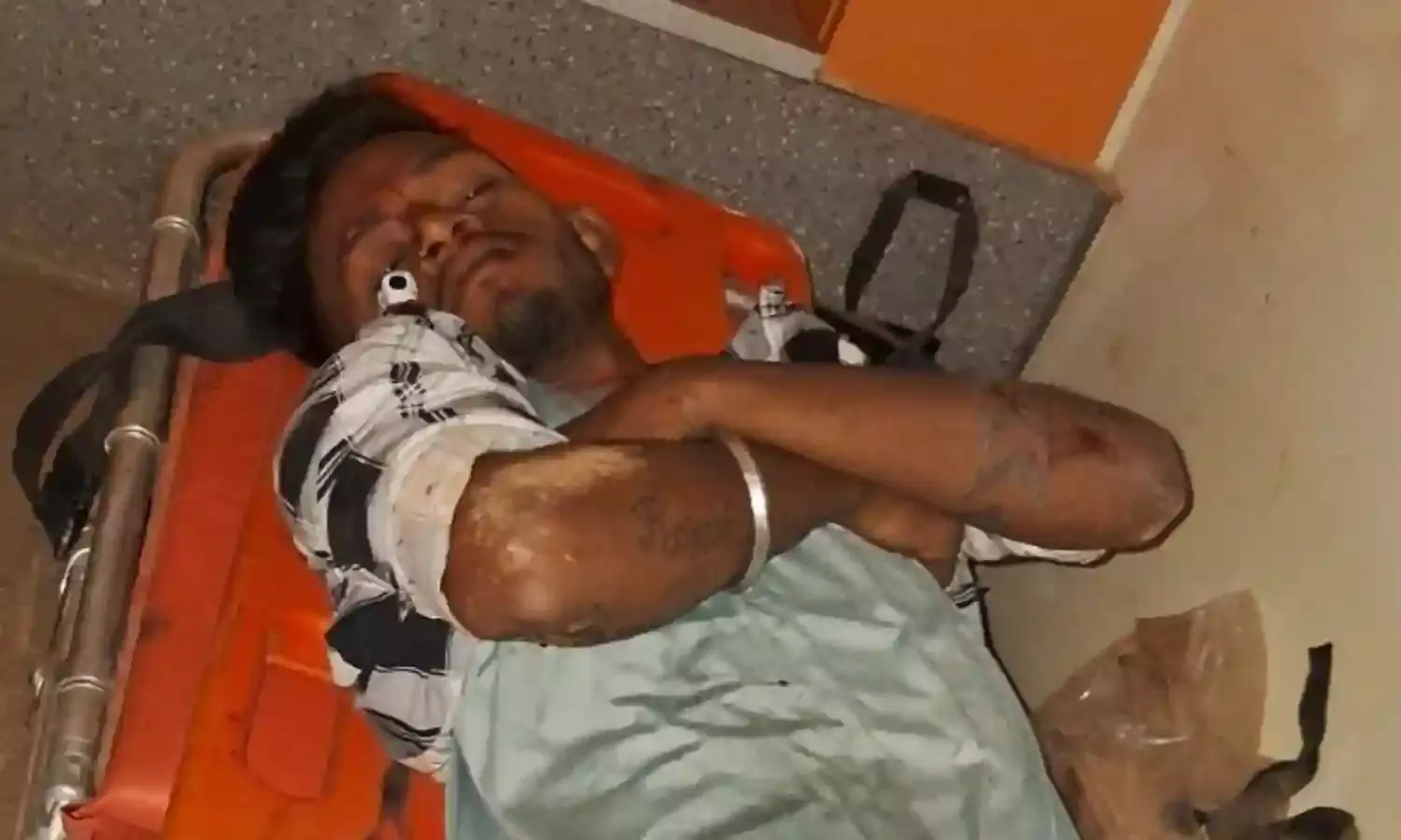 ट्रक और मोटरसाइकिल की सीधी भिडंत, सवार तीन घायल