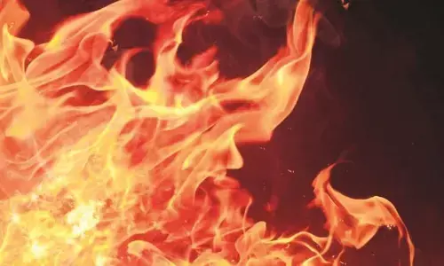 कचरा जलाते समय झुलसी महिला की मौत