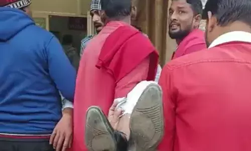 प्लेटफार्म पर बैटरी कार ने यात्री को मारी टक्कर प्लेटफार्म पर बैटरी कार ने यात्री को मारी टक्कर