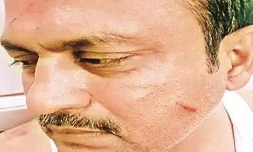 अवैध बिजली कनेक्शन काटने पहुंचे इंजीनियर को पीटा