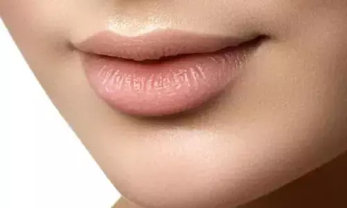 होठों को सुंदर आकार देने के लिए महिला ने कराई सर्जरी, इसके बाद जो हुआ जानकर हो जाएंगे हक्के बक्के