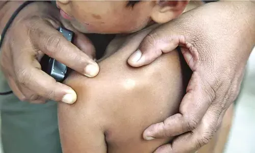 मरीजों की तलाश करेंगी 1125 टीमें, जिले में दो लाख 65 हजार परिवारों की होगी जांच