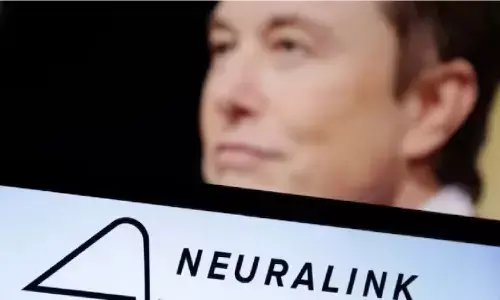 मस्क के ब्रेन इम्प्लांट स्टार्टअप ने जुटाए अतिरिक्त 43 मिलियन डॉलर