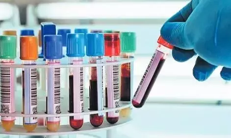 घरों से ब्लड सैंपल लेने में अनाड़ी साबित हो रहे पैथोलाॅजी सेंटर के कलेक्शन एजेंट घरों से ब्लड सैंपल लेने में अनाड़ी साबित हो रहे पैथोलाॅजी सेंटर के कलेक्शन एजेंट
