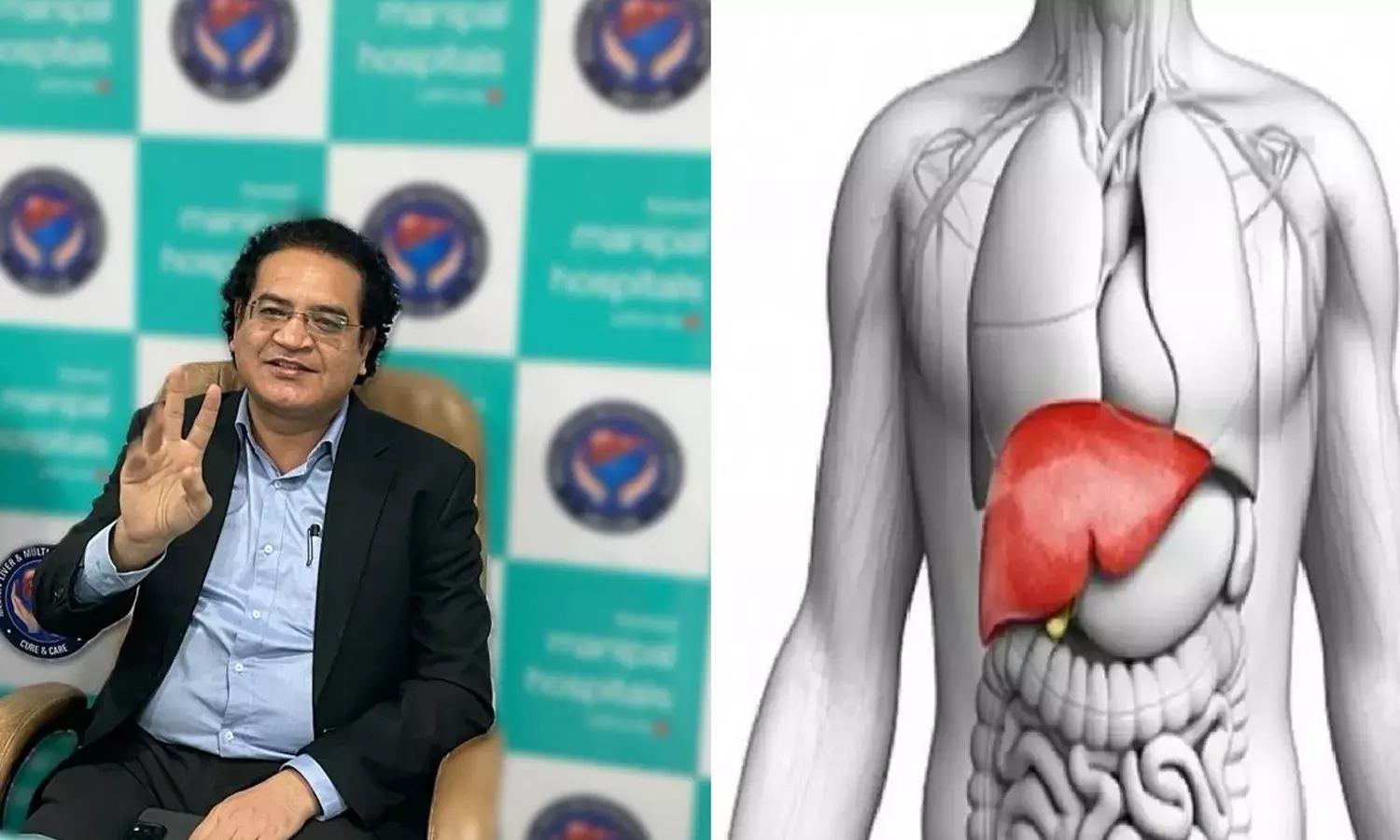 अल्कोहल और खराब खानपान से बढ़ रही फैटी लिवर की समस्या, भारत में हर वर्ष 50 हजार ट्रांसप्लांट की जरुरत, हो रहे सिर्फ 1500!