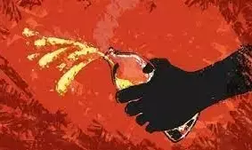 पालतू कुत्ते को डांट रहा था पड़ोसी, गलतफहमी के शिकार शख्स ने फेंका तेजाब पालतू कुत्ते को डांट रहा था पड़ोसी, गलतफहमी के शिकार शख्स ने फेंका तेजाब