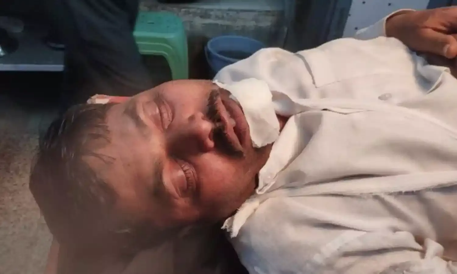 मोटरसाइकिल हुई अनियंत्रित, दो युवक घायल