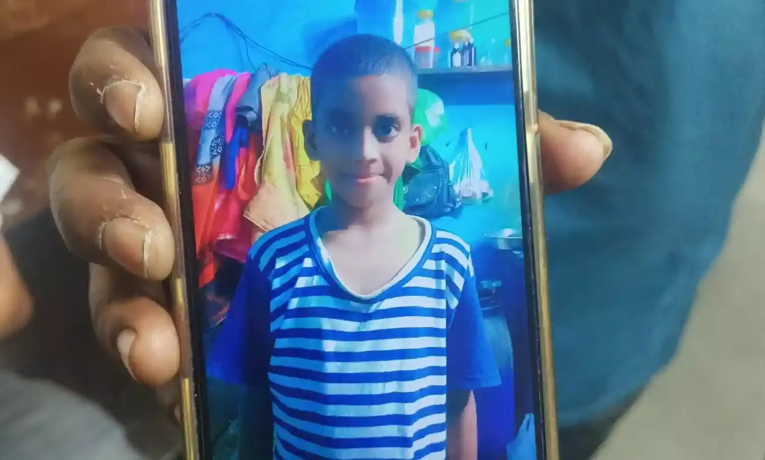 ठाणे के कलवा मनपा अस्पताल के डॉक्टरों की भयंकर लापरवाही, नाबालिग ने गंवाया  हाथ