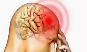 ब्रिटेन का एंगस बेन अब मिर्गी से मुक्त, सर्जरी से निकाला गया मस्तिष्क का एक हिस्सा