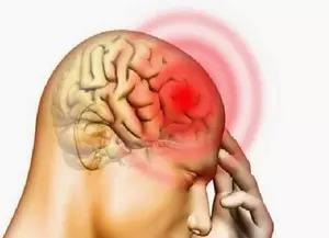 ब्रिटेन का एंगस बेन अब मिर्गी से मुक्त, सर्जरी से निकाला गया मस्तिष्क का एक हिस्सा ब्रिटेन का एंगस बेन अब मिर्गी से मुक्त, सर्जरी से निकाला गया मस्तिष्क का एक हिस्सा