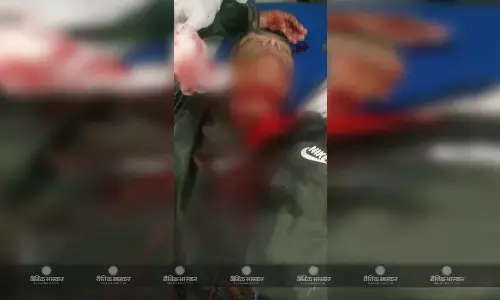 बाइक सवार युवक का कटा गला, १३ सेमी लम्बा और ७ सेमी चौड़ा घाव, हालत नाजुक बाइक सवार युवक का कटा गला, १३ सेमी लम्बा और ७ सेमी चौड़ा घाव, हालत नाजुक