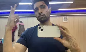 अदिवि शेष ने जी2 के सेट से घावों के निशान वाली बीटीएस तस्वीर साझा की