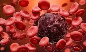 कम डोज, ज्यादा कारगर , कीमोथेरेपी के साइड इफेक्ट पर नियंत्रण में सफलता