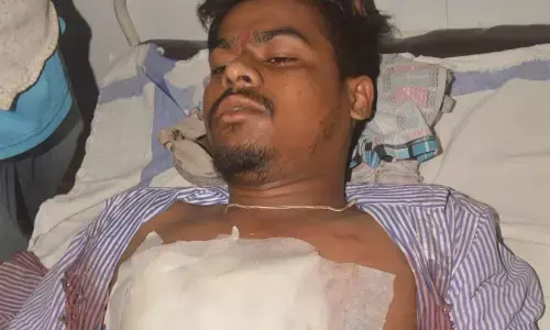 घर के दरवाजे पर नकाबपोश ने ऑटो ड्राइवर को मारी गोली घर के दरवाजे पर नकाबपोश ने ऑटो ड्राइवर को मारी गोली