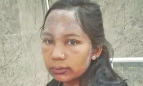 मधुमक्खियों के हमले में तीन छात्राएं हुई घायल, ग्रामीण अस्पताल में कराया भर्ती