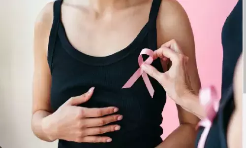 स्तन कैंसर से 2040 तक प्रतिवर्ष 10 लाख लोगों की मौत होने की आशंका: लैंसेट रिपोर्ट स्तन कैंसर से 2040 तक प्रतिवर्ष 10 लाख लोगों की मौत होने की आशंका: लैंसेट रिपोर्ट