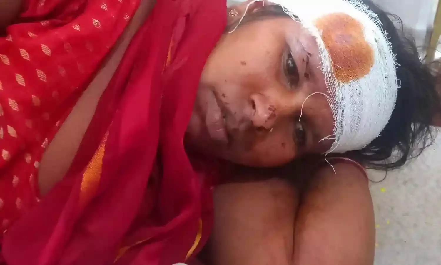 बाइक अनियंत्रित होकर गिरी, दो लोग घायल, बच्चा सुरक्षित