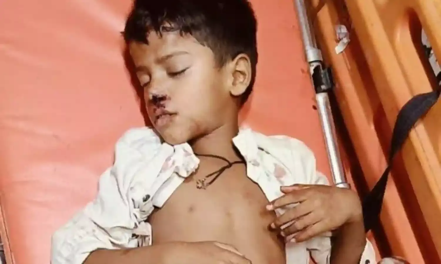 छत से गिरकर चोटिल हुआ छ: वर्षीय बालक