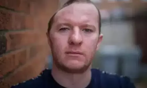 आधे सिर के साथ जी रहा यह आदमी, हर पल बना रहता है मौत का डर!