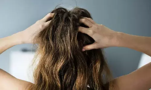 स्कैल्प की ड्राईनेस और डैंड्रफ के कारण सर में होती है खुजली तो, इन होम रमेडीज से मिल सकता है छुटकारा